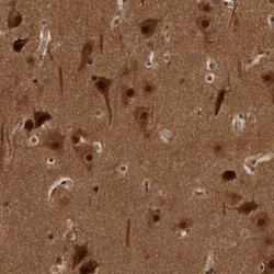 AKT3 Antibody, Novus Biologicals 25 &mu;L; Unlabeled:Antibodies, Polyclonal