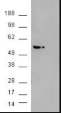 AKT3 Antibody, Novus Biologicals 0.1mg; Unlabeled:Antibodies, Polyclonal