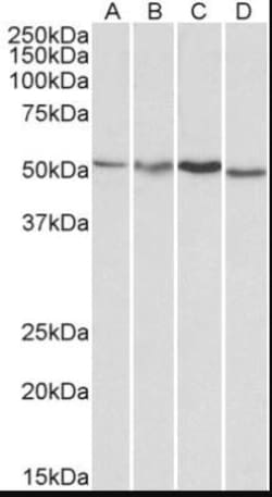 AKT3 Antibody, Novus Biologicals 0.1mg; Unlabeled:Antibodies, Polyclonal