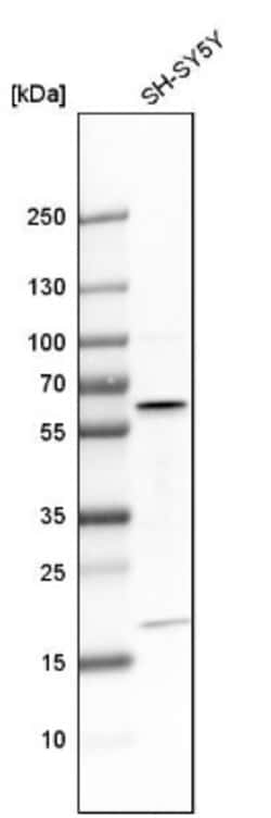 AKT3 Antibody, Novus Biologicals 25 &mu;L; Unlabeled:Antibodies, Polyclonal