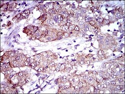ALCAM/CD166 Antibody (8E12C7) - BSA Free, Novus Biologicals:Antibodies:Primary