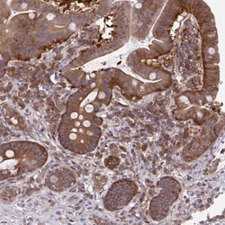ALDH16A1 Antibody, Novus Biologicals 25 &mu;L, Unlabeled:Antibodies, Polyclonal