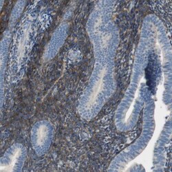 ALDH1A2 Antibody, Novus Biologicals:Antibodies:Primary Antibodies