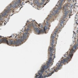 ALDH1A2 Antibody, Novus Biologicals:Antibodies:Primary Antibodies