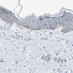 ALDH1A2 Antibody, Novus Biologicals:Antibodies:Primary Antibodies