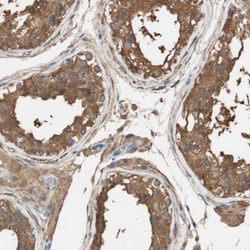 ALDH1A2 Antibody, Novus Biologicals:Antibodies:Primary Antibodies