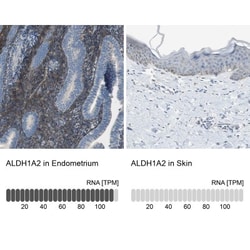 ALDH1A2 Antibody, Novus Biologicals:Antibodies:Primary Antibodies