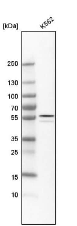 ALDH1A2 Antibody, Novus Biologicals:Antibodies:Primary Antibodies