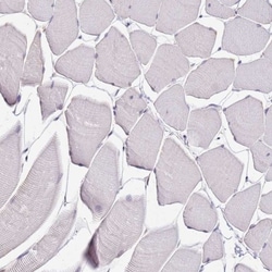 ALDH1A3 Antibody, Novus Biologicals:Antibodies:Primary Antibodies