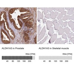 ALDH1A3 Antibody, Novus Biologicals:Antibodies:Primary Antibodies