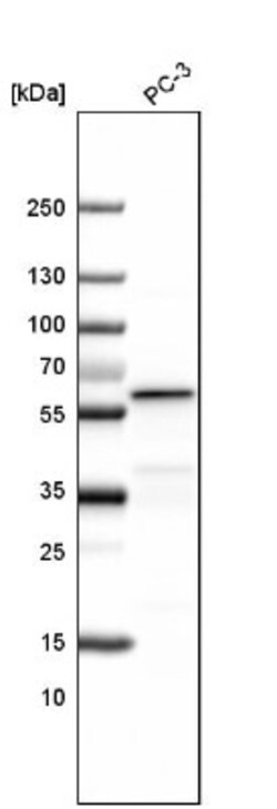 ALDH1A3 Antibody, Novus Biologicals:Antibodies:Primary Antibodies