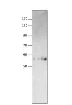 ALDH1A3 Antibody, Novus Biologicals 100 &mu;g | Buy Online | Novus Biologicals | Fisher Scientific