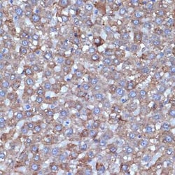 ALDH1L1 Rabbit anti-Human, Mouse, Rat, Clone: 6H10Y3, Novus Biologicals 20 &mu;g | Buy Online | Novus Biologicals | Fisher Scientific