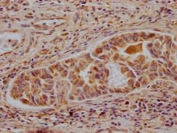 ALDH2 Antibody (3F10), Novus Biologicals 100 &mu;g; Unconjugated:Antibodies,