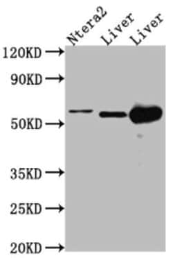ALDH2 Antibody (3F10), Novus Biologicals 100 &mu;g; Unconjugated:Antibodies,