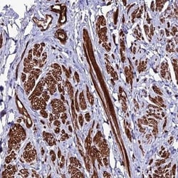 ALDH3B2 Antibody, Novus Biologicals:Antibodies:Primary Antibodies