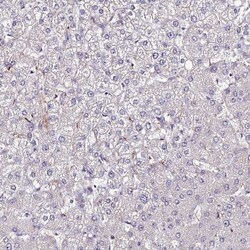 ALDH3B2 Antibody, Novus Biologicals:Antibodies:Primary Antibodies