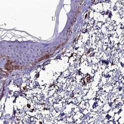 ALDH3B2 Antibody, Novus Biologicals:Antibodies:Primary Antibodies