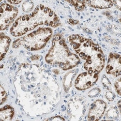 ALDH4A1 Antibody, Novus Biologicals:Antibodies:Primary Antibodies