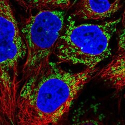 ALDH5A1 Antibody, Novus Biologicals 25 &mu;L; Unlabeled:Antibodies, Polyclonal