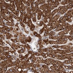 ALDH5A1 Antibody, Novus Biologicals 25 &mu;L; Unlabeled:Antibodies, Polyclonal