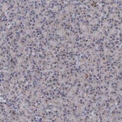 ALDH5A1 Antibody, Novus Biologicals 25 &mu;L; Unlabeled:Antibodies, Polyclonal