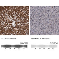 ALDH5A1 Antibody, Novus Biologicals 25 &mu;L; Unlabeled:Antibodies, Polyclonal