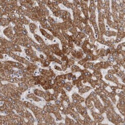 GALT Antibody, Novus Biologicals:Antibodies:Primary Antibodies