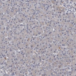 GALT Antibody, Novus Biologicals:Antibodies:Primary Antibodies