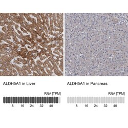 GALT Antibody, Novus Biologicals:Antibodies:Primary Antibodies