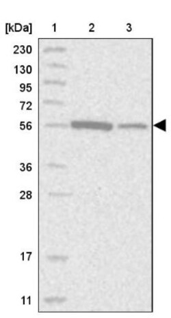 ALDH5A1 Antibody, Novus Biologicals 25 &mu;L; Unlabeled:Antibodies, Polyclonal