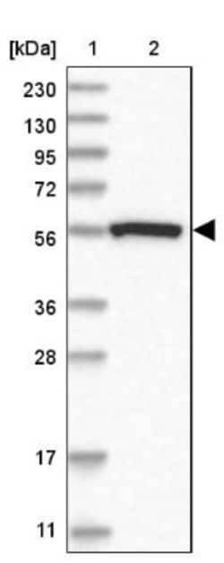GALT Antibody, Novus Biologicals:Antibodies:Primary Antibodies