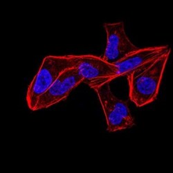 ALDH6A1 Antibody (6H9B8) - BSA Free, Novus Biologicals 0.1mg; Unlabeled:Antibodies,