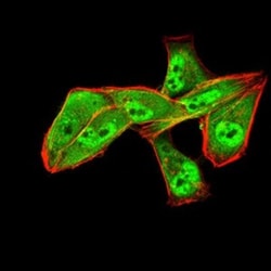 ALDH6A1 Antibody (6H9B8) - BSA Free, Novus Biologicals 0.1mg; Unlabeled:Antibodies,