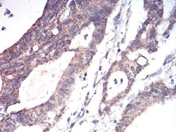 ALDH6A1 Antibody (6H9B8) - BSA Free, Novus Biologicals 0.1mg; Unlabeled:Antibodies,