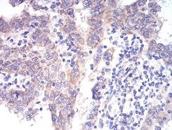 ALDH6A1 Antibody (6H9B8) - BSA Free, Novus Biologicals 0.1mg; Unlabeled:Antibodies,