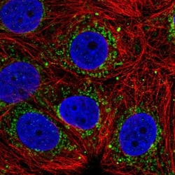 ALDH6A1 Antibody, Novus Biologicals:Antibodies:Primary Antibodies