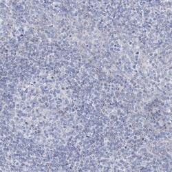 ALDH6A1 Antibody, Novus Biologicals:Antibodies:Primary Antibodies