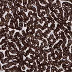 ALDH6A1 Antibody, Novus Biologicals:Antibodies:Primary Antibodies