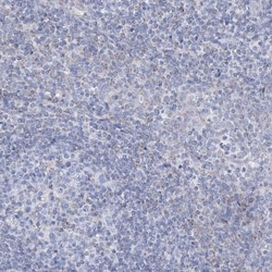 ALDH6A1 Antibody, Novus Biologicals:Antibodies:Primary Antibodies