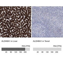 ALDH6A1 Antibody, Novus Biologicals:Antibodies:Primary Antibodies