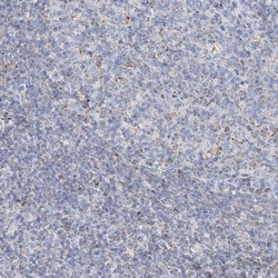 ALDH6A1 Antibody, Novus Biologicals:Antibodies:Primary Antibodies