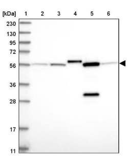 ALDH6A1 Antibody, Novus Biologicals:Antibodies:Primary Antibodies