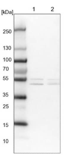 ALDH6A1 Antibody, Novus Biologicals:Antibodies:Primary Antibodies