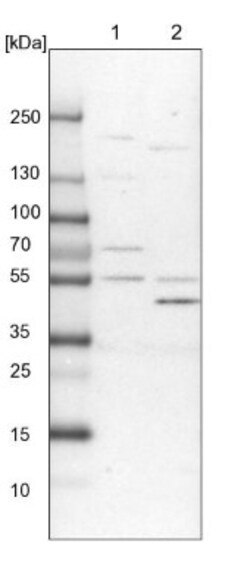 ALDH6A1 Antibody, Novus Biologicals:Antibodies:Primary Antibodies