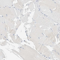 ALDH7A1 Antibody, Novus Biologicals 25 &mu;L | Buy Online | Novus Biologicals | Fisher Scientific