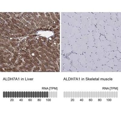 ALDH7A1 Rabbit anti-Human, Polyclonal, Novus Biologicals 100 &mu;g; Unconjugated:Antibodies,