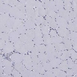 ALDH7A1 Rabbit anti-Human, Polyclonal, Novus Biologicals 100 &mu;g; Unconjugated:Antibodies,