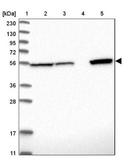ALDH7A1 Antibody, Novus Biologicals 25 &mu;L | Buy Online | Novus Biologicals | Fisher Scientific
