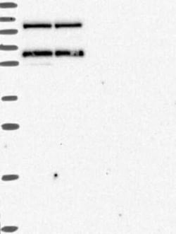 ALDH7A1 Rabbit anti-Human, Polyclonal, Novus Biologicals 100 &mu;g; Unconjugated:Antibodies,
